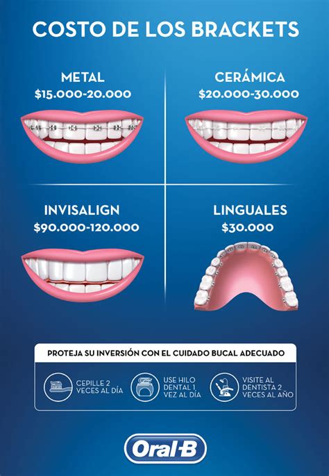 precio brackets metalicos|precio de brackets en mexico.